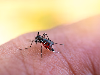 Mosquito bites