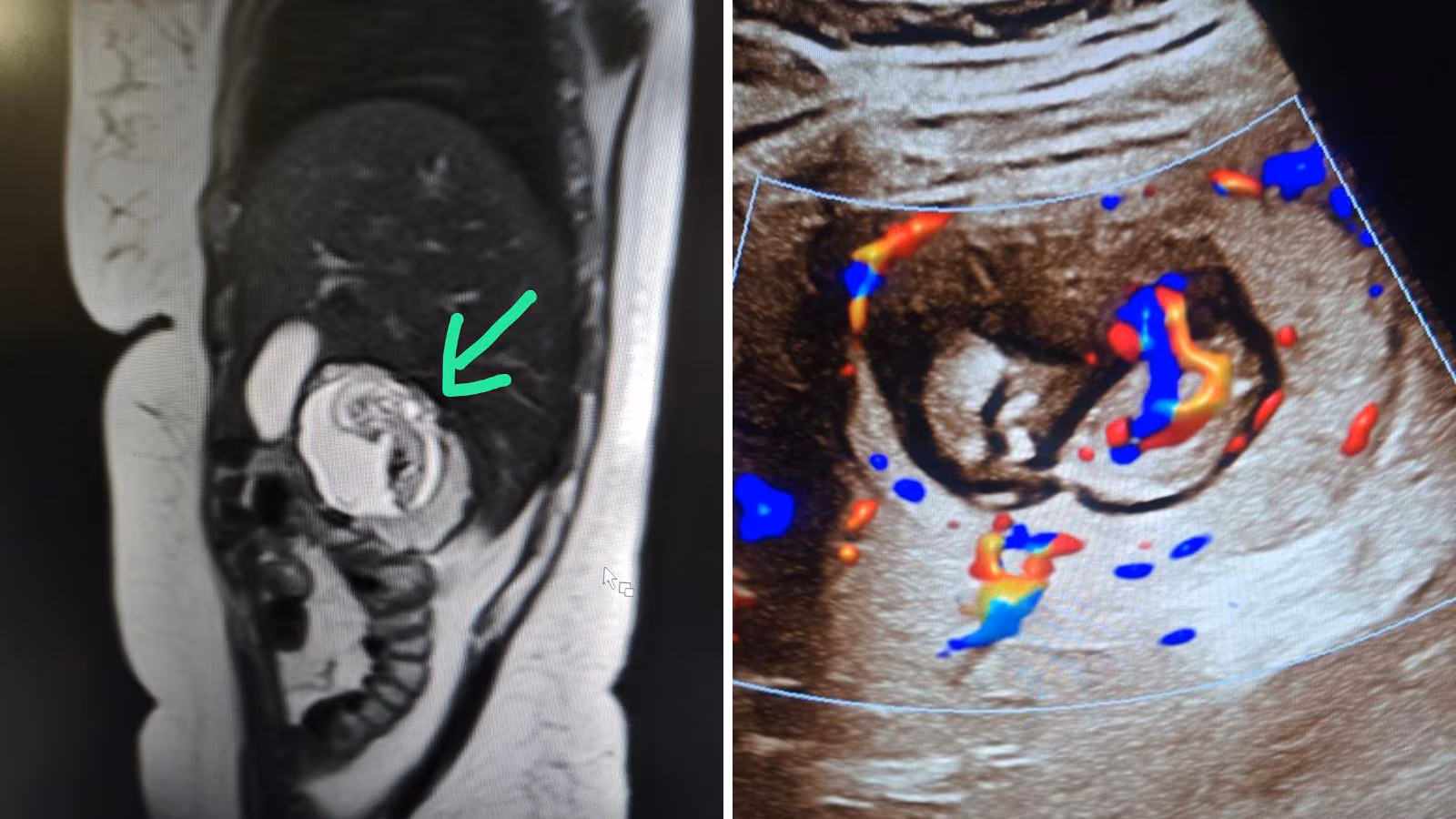 New 5 2025 07 05f83630ed8ddebef67b7cbf2c27ec93