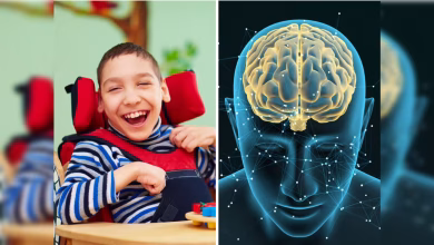Cerebral palsy treatment
